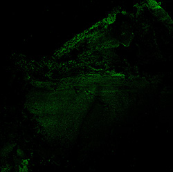 17PCW human midbrain